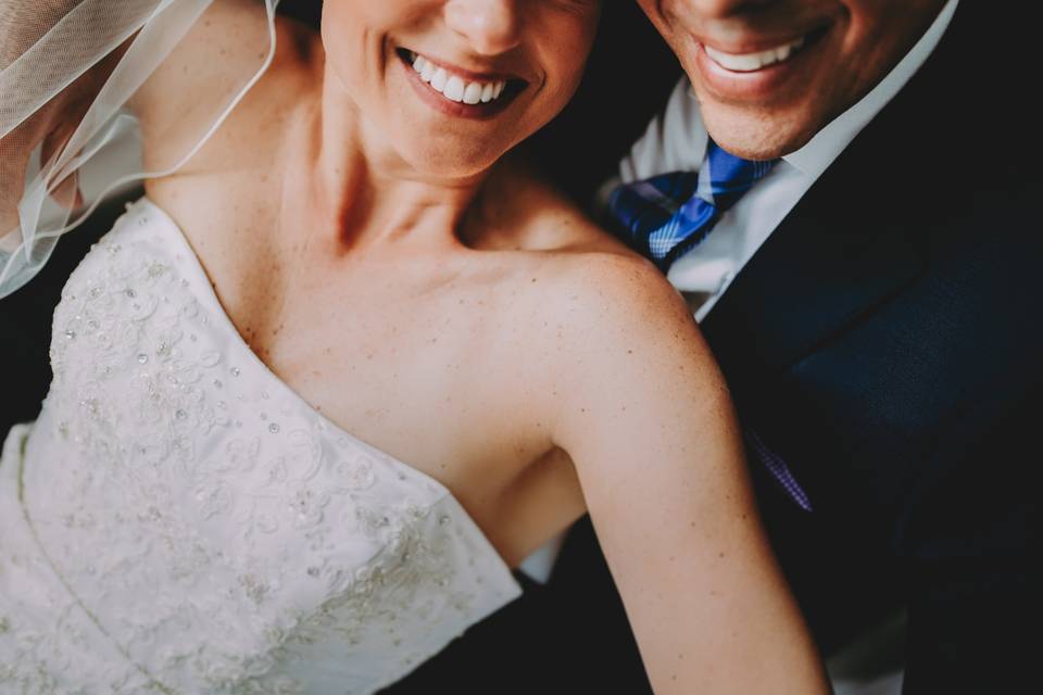 Dientes blancos: 4 claves para tener una sonrisa espectacular en tu boda